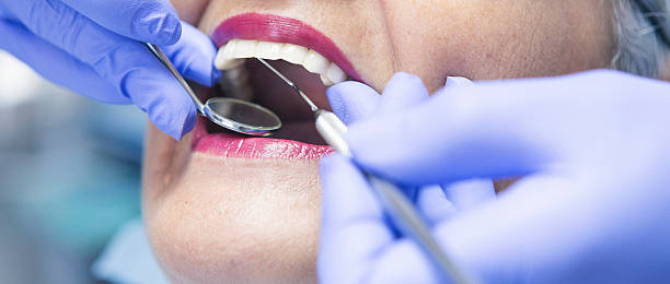 Best Emergency Cosmetic Dentistry (e.g., broken veneers) in Williams, CA